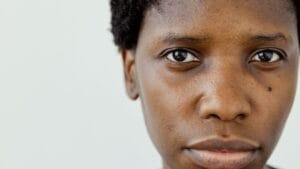 Black woman with natural skin texture for a hyperpigmentation skincare Kenya guide
